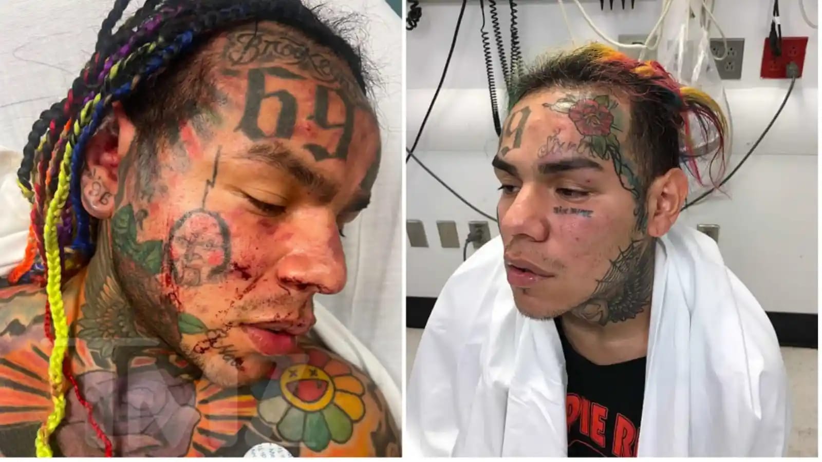 Tekashi with face injuries